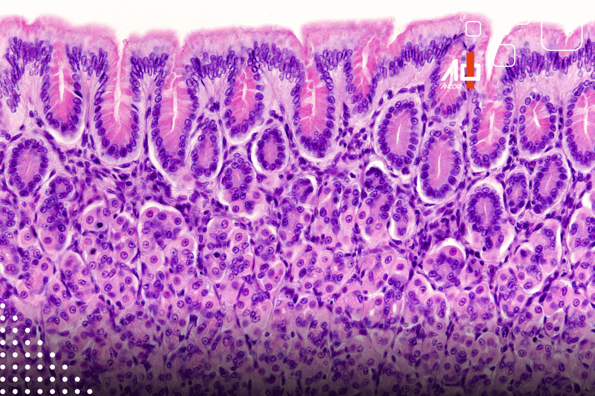 Descrição da imagem