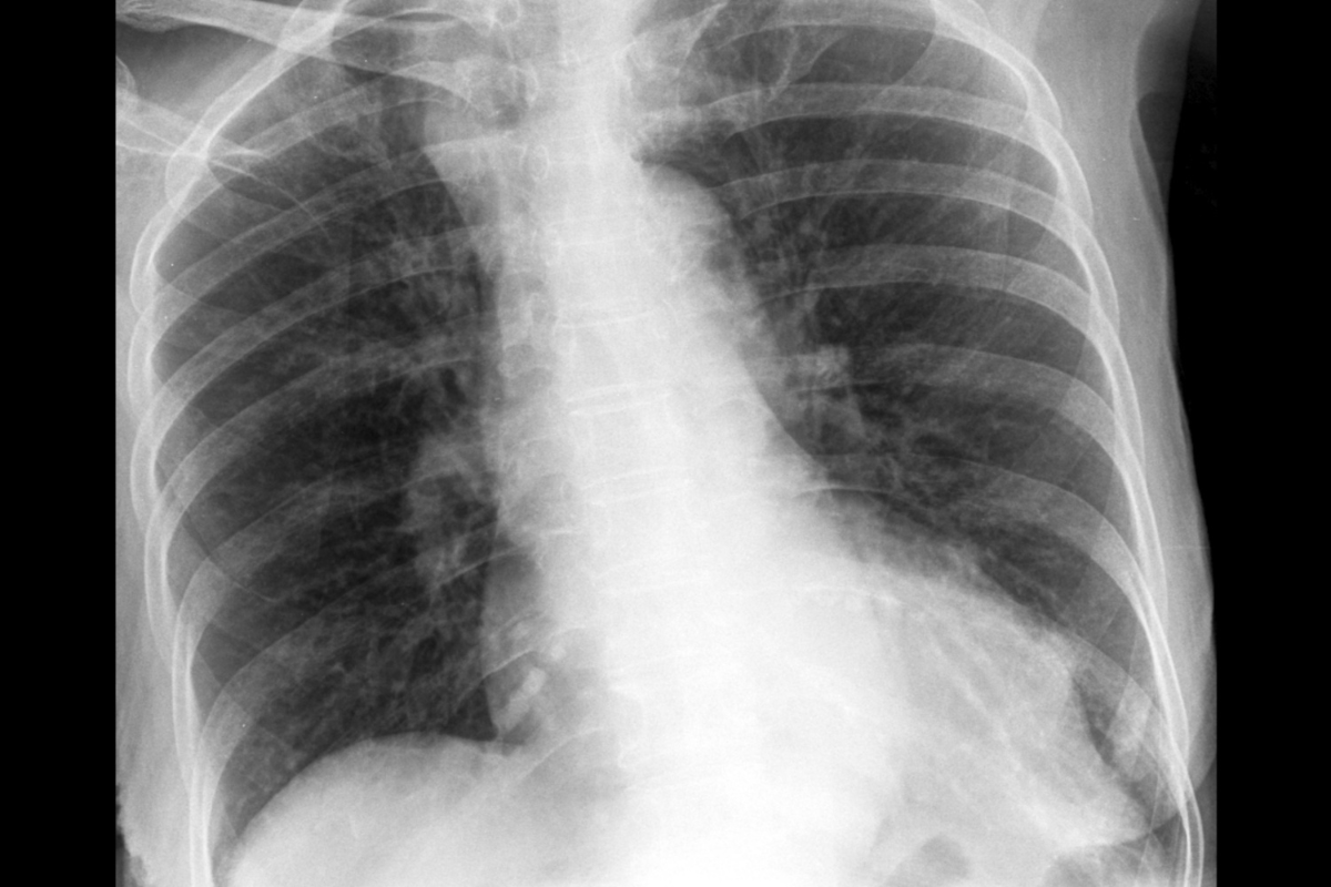 Descrição da imagem