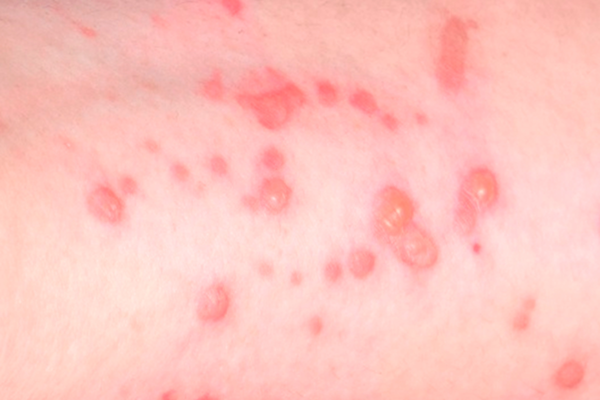 Descrição da imagem