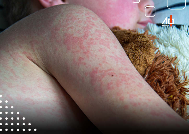 Descrição da imagem