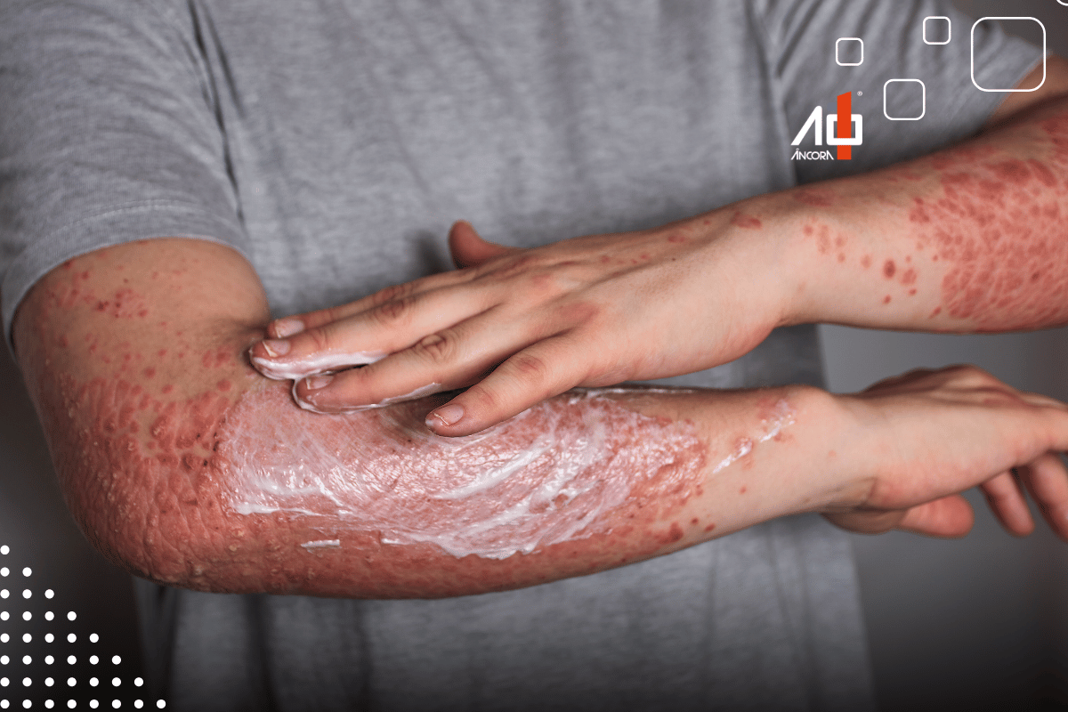 Descrição da imagem