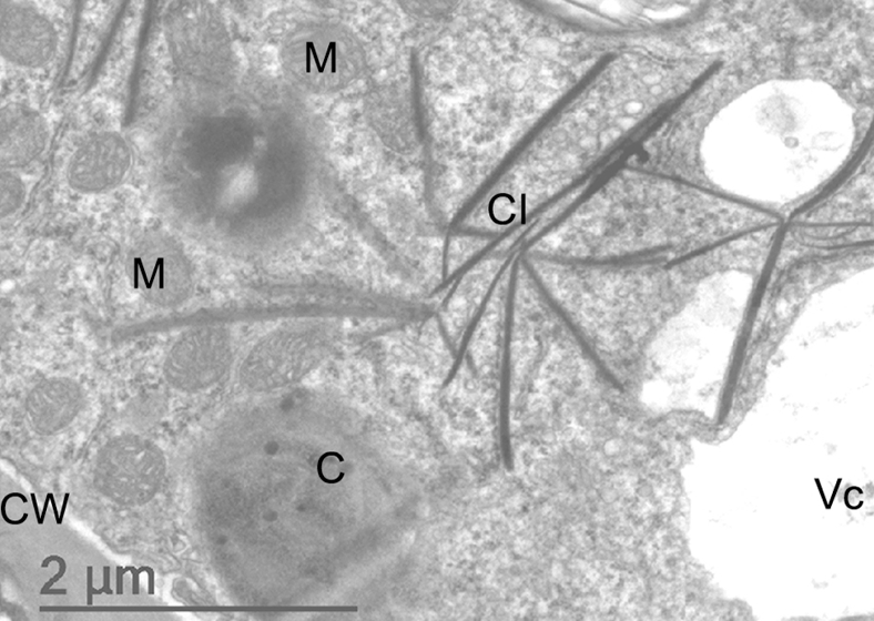 Fotos de microscópio do vírus BiMoV