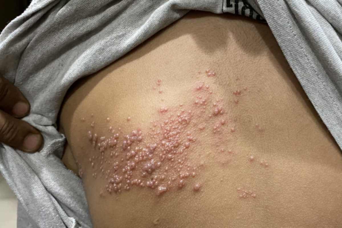 Descrição da imagem