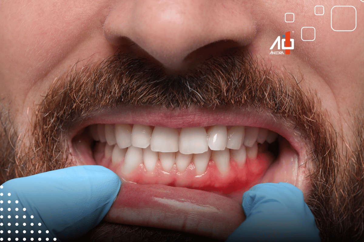 Descrição da imagem