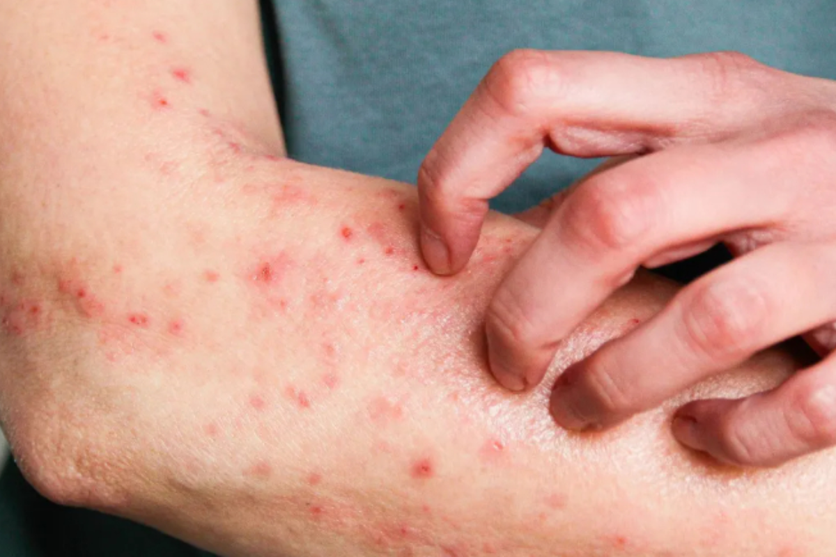 Descrição da imagem